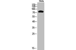 Western Blot analysis of Hela cells using Acetyl-Ub (K48) Polyclonal Antibody (UBA52/RPS27A/UBB/UBC (acLys48) antibody)