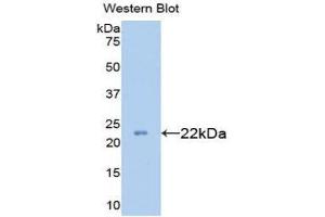 COL18 antibody  (AA 1591-1774)