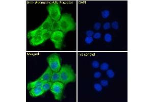 ABIN185477 Immunofluorescence analysis of paraformaldehyde fixed A431 cells, permeabilized with 0. (Adenosine A2b Receptor antibody  (C-Term))