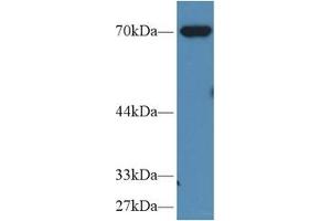 Detection of MSN in Porcine Pancreas lysate using Polyclonal Antibody to Moesin (MSN) (Moesin antibody  (AA 354-577))