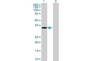 Western Blot analysis of MGC26694 expression in transfected 293T cell line by MGC26694 MaxPab polyclonal antibody. (SLC25A42 antibody  (AA 1-318))