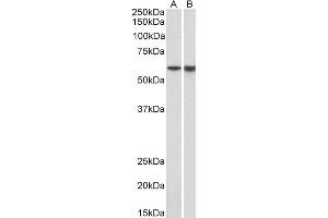 ABIN987272 (1µg/ml) staining of Pig Bone Marrow (A) and Spleen (B) lysates (35µg protein in RIPA buffer). (LCK antibody  (AA 39-52))
