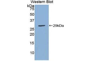 Western Blotting (WB) image for anti-Inhibitor of KB Kinase beta Interacting Protein (IKbIP) (AA 78-301) antibody (ABIN1859322)