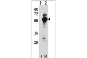 Western Blotting (WB) image for anti-Aspartyl-tRNA Synthetase (DARS) (AA 154-183), (N-Term) antibody (ABIN655040)