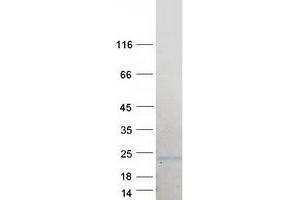 Validation with Western Blot (BCL7B Protein (Transcript Variant 2) (Myc-DYKDDDDK Tag))