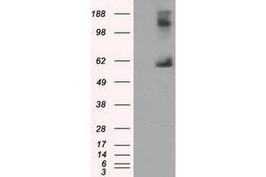 Image no. 1 for anti-Lipase, Endothelial (LIPG) antibody (ABIN1499167) (LIPG antibody)