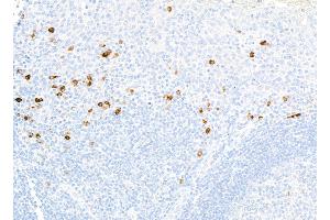 Immunohistochemistry (IHC) image for anti-CD80 (CD80) (AA 35-246) antibody (ABIN7449415)