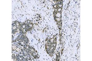 IHC analysis of CSNK2B using anti-CSNK2B antibody (ABIN7599092).