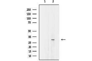 anti-Asparaginase Like 1 (ASRGL1) (Internal Region) antibody