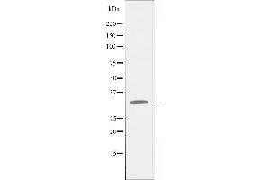 Western blot analysis of extracts from HepG2 cells using RPL5 antibody.