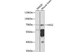 Western blot analysis of extracts of various cell lines, using H antibody (ABIN6129690, ABIN6141613, ABIN6141614 and ABIN6225245) at 1:1000 dilution. (HAS2 antibody  (AA 67-185))