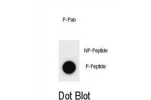 Dot blot analysis of E Antibody (Phospho ) Phospho-specific Pab (ABIN1881299 and ABIN2839953) on nitrocellulose membrane. (p300 antibody  (pSer1834))