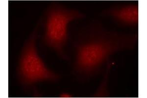 Image no. 3 for anti-Retinoblastoma 1 (RB1) (pSer795) antibody (ABIN196838) (Retinoblastoma 1 antibody  (pSer795))