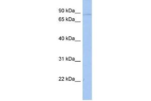 WB Suggested Anti-ATXN7L2 Antibody Titration: 0. (ATXN7L2 antibody  (Middle Region))