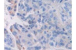 Immunohistochemistry (IHC) image for anti-Fibroblast Growth Factor Receptor 3 (FGFR3) (AA 166-375) antibody (ABIN7434086)
