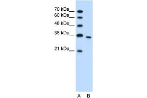 WB Suggested Anti-PRPS2 Antibody Titration:  1. (PRPS2 antibody  (N-Term))