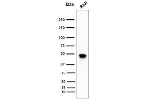Western Blot Analysis of human Raji cell lysate using CD79a Rabbit Recombinant Monoclonal Antibody (IGA/1688R). (Recombinant CD79a antibody  (AA 202-216))