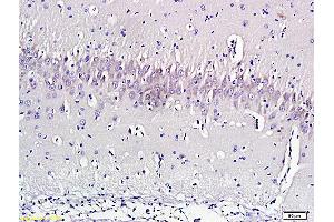 Formalin-fixed and paraffin embedded rat brain labeled with Anti-Nociceptin Polyclonal Antibody, Unconjugated (ABIN724535) 1:300 followed by conjugation to the secondary antibody and DAB staining