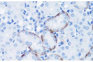 Immunohistochemistry of paraffin-embedded Mouse kidney using Phospho-P70 S6K(T389) Polyclonal Antibody at dilution of 1:100 (40x lens). (RPS6KB1 antibody  (pThr389))