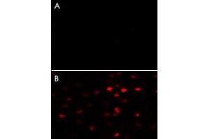 A : Negative control of HeLa cells without Alexa-Fluor-546-conjugated donkey anti-rabbit lgG (H+L). (PKM2 antibody  (AA 483-513))