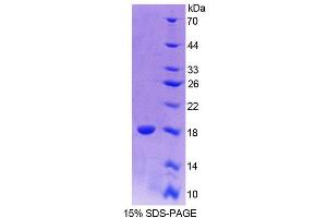 SDS-PAGE (SDS) image for Paired Box 6 (PAX6) (AA 1-130) protein (His tag) (ABIN4990701)
