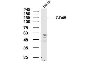 Western Blotting (WB) image for anti-Protein tyrosine Phosphatase, Receptor Type, C (PTPRC) (AA 501-600) antibody (ABIN2172749)