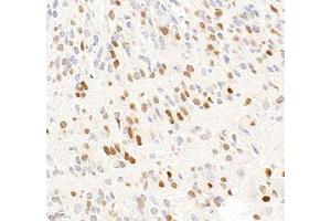 Immunohistochemistry of paraffin embedded mouse embryonic mouse using OTX2 (ABIN7074952) at dilution of 1:600 (400x lens) (OTX2 antibody)
