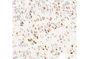 Immunohistochemistry of paraffin embedded mouse embryonic mouse using OTX2 (ABIN7074952) at dilution of 1:600 (400x lens) (OTX2 antibody)