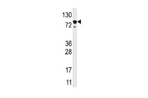 Western blot analysis of anti-EPS15 Pab (ABIN388933 and ABIN2839202) in HL60 cell line lysate (35 μg/lane). (EPS15 antibody  (C-Term))