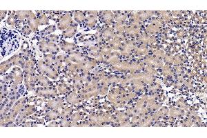 Detection of MAP2K7 in Mouse Kidney Tissue using Polyclonal Antibody to Mitogen Activated Protein Kinase Kinase 7 (MAP2K7) (MAP2K7 antibody  (AA 113-388))