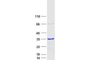 Validation with Western Blot (CACYBP Protein (Transcript Variant 2) (Myc-DYKDDDDK Tag))