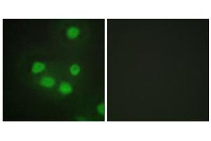 Immunofluorescence analysis of HepG2 cells, using SIX6 antibody. (SIX Homeobox 6 antibody  (Internal Region))
