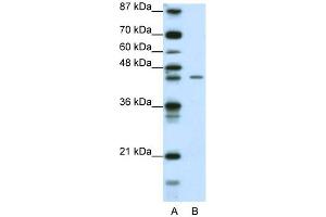 WB Suggested Anti-ZNF17 Antibody Titration: 0. (ZNF17 antibody  (N-Term))