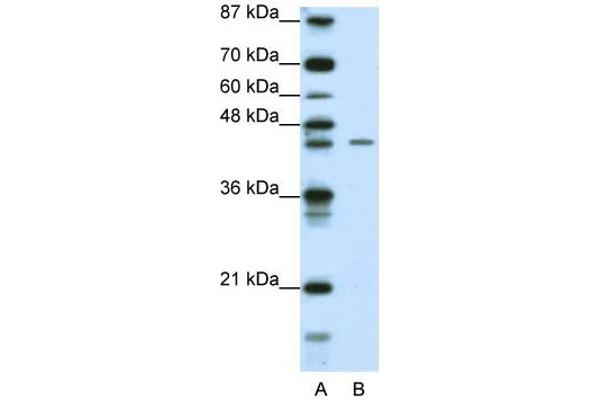 ZNF17 antibody  (N-Term)