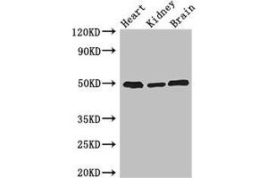 Western Blot Positive WB detected in: Mouse heart tissue, Mouse kidney tissue, Mouse brain tissue All lanes: ANKRD10 antibody at 4 μg/mL Secondary Goat polyclonal to rabbit IgG at 1/50000 dilution Predicted band size: 45, 24 kDa Observed band size: 50 kDa (ANKRD1 antibody  (AA 1-220))