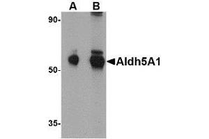 Western blot analysis of Aldh5A1 in mouse liver lysate with AP30045PU-N Aldh5A1 antibody at (A) 1 and (B) 2 μg/ml.