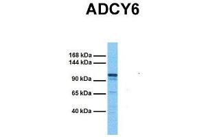Host:  Rabbit  Target Name:  ADCY6  Sample Tissue:  Human Fetal Kidney  Antibody Dilution:  1. (ADCY6 antibody  (C-Term))