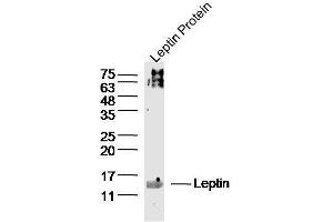 Leptin lysates probed with Leptin Polyclonal Antibody, Unconjugated  at 1:300 dilution and 4˚C overnight incubation. (Leptin antibody  (AA 17-100))