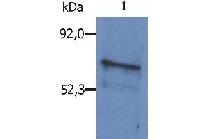 Western Blotting analysis (reducing conditions) of whole cell lysate of Sp2/0 mouse myeloma cell line using polyclonal anti-mouse SLP65 / BLNK antibody . (B-Cell Linker antibody  (AA 171-356))