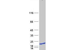 Western Blotting (WB) image for GSK3B interacting protein (GSKIP) protein (Myc-DYKDDDDK Tag) (ABIN2722265)