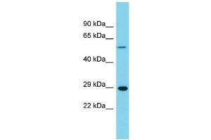 Host: Rabbit  Target Name: Uchl1  Sample Tissue: Rat Stomach lysates  Antibody Dilution: 1. (UCHL1 antibody  (Middle Region))