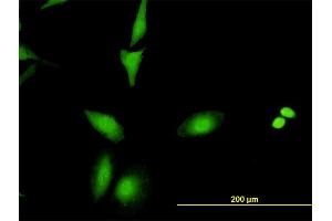 Immunofluorescence of monoclonal antibody to CRADD on HeLa cell.