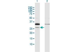 Western Blot analysis of PPAP2A expression in transfected 293T cell line by PPAP2A MaxPab polyclonal antibody. (PPAP2A antibody  (AA 1-284))