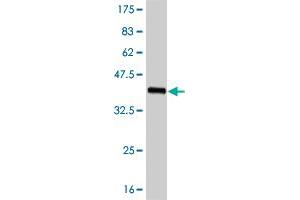 Western Blot detection against Immunogen (37. (FOXC2 antibody  (AA 156-256))