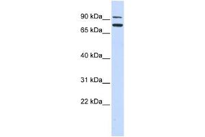 WB Suggested Anti-ZNF440 Antibody Titration:  0. (ZNF440 antibody  (Middle Region))