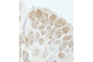 Immunohistochemistry (IHC) image for anti-Drosha, Ribonuclease Type III (DROSHA) (AA 1050-1100) antibody (ABIN7448535)