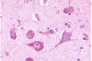 Immunohistochemical staining of human brain, neurons with LPHN3 polyclonal antibody . (LPHN3 antibody  (C-Term))