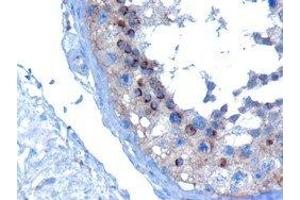 ABIN2560743 (10µg/ml) staining of paraffin embedded Human Testis. (VPS28 antibody  (C-Term))