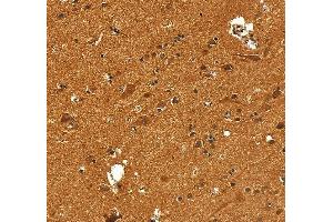 IHC analysis of VCP using anti-VCP antibody (ABIN7599605). (VCP antibody  (AA 10-512))