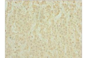 Immunohistochemistry of paraffin-embedded human adrenal gland tissue using ABIN7163721 at dilution of 1:100 (POC1A antibody  (AA 138-407))